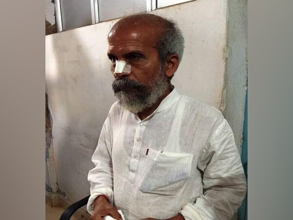 Union Minister Pratap Sarangi injured by Road accident
